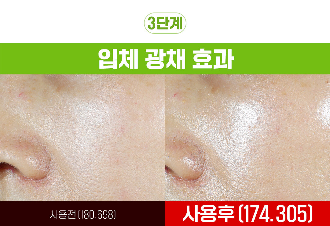 thumbnail-16